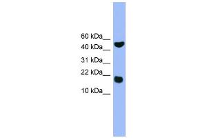 WB Suggested Anti-RWDD1 Antibody Titration: 0. (RWDD1 antibody  (Middle Region))