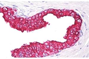 Immunohistochemistry staining of human prostate (paraffin section) using anti-cytokeratin 5/8 (clone C-50). (Keratin 5/8 antibody)