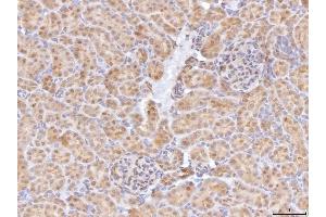 IHC analysis of BHMT using anti-BHMT antibody (ABIN7599940). (BHMT antibody  (AA 13-386))