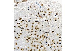 Immunohistochemistry of paraffin embedded mouse brain using UBE3A (ABIN7076104) at dilution of 1:1000 (400x lens) (ube3a antibody)