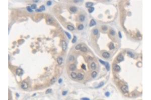 Detection of NSF in Human Kidney Tissue using Polyclonal Antibody to N-Ethylmaleimide Sensitive Factor (NSF) (NSF antibody  (AA 590-744))