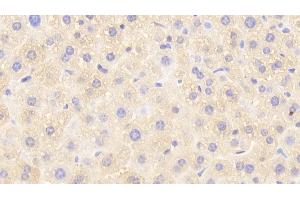 Detection of GSTp in Mouse Liver Tissue using Polyclonal Antibody to Glutathione S Transferase Pi (GSTp) (GSTP1 antibody  (AA 1-210))