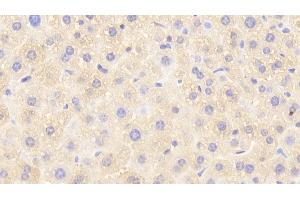 Detection of GSTp in Mouse Liver Tissue using Polyclonal Antibody to Glutathione S Transferase Pi (GSTp) (GSTP1 antibody  (AA 1-210))