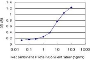 Detection limit for recombinant GST tagged LMTK2 is approximately 0. (LMTK2 antibody  (AA 1181-1280))