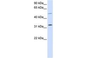 Image no. 1 for anti-Short Stature Homeobox 2 (SHOX2) (AA 108-157) antibody (ABIN6744236) (SHOX2 antibody  (AA 108-157))