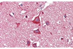 Immunohistochemistry (IHC) image for anti-Hexosaminidase B (Beta Polypeptide) (HEXB) (AA 122-311) antibody (ABIN7438553)