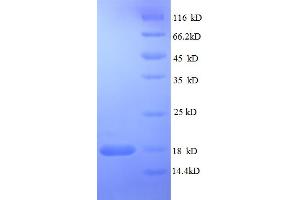 SDS-PAGE (SDS) image for RELT Tumor Necrosis Factor Receptor (RELT) (AA 26-153), (partial) protein (His tag) (ABIN5712560) (RELT Protein (AA 26-153, partial) (His tag))