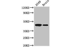 Western Blot Positive WB detected in: A549 whole cell lysate, Mouse brain tissue All lanes: AMT antibody at 3. (Aminomethyltransferase antibody  (AA 180-260))