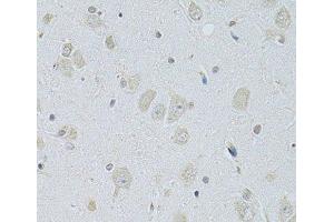 Immunohistochemistry of paraffin-embedded Rat brain using SLC29A1 Polyclonal Antibody at dilution of 1:100 (40x lens). (SLC29A1 antibody)