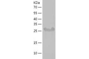 Western Blotting (WB) image for Tubby Like Protein 1 (TULP1) (AA 290-542) protein (His tag) (ABIN7284239) (TULP1 Protein (AA 290-542) (His tag))