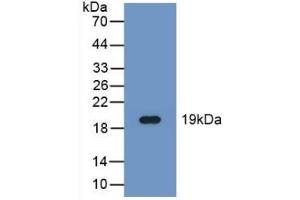 Detection of Recombinant FADS2, Human using Polyclonal Antibody to Fatty Acid Desaturase 2 (FADS2) (FADS2 antibody  (AA 1-130))