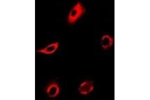 Immunofluorescent analysis of PPX staining in MCF7 cells. (PPP4C antibody)