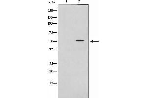 Western blot analysis on 293 cell lysate using IRX2 Antibody,The lane on the left is treated with the antigen-specific peptide.
