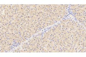 Detection of PROC in Human Liver Tissue using Polyclonal Antibody to Protein C (PROC) (PROC antibody)
