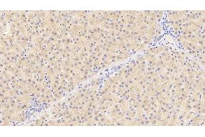 Detection of PROC in Human Liver Tissue using Polyclonal Antibody to Protein C (PROC) (PROC antibody)