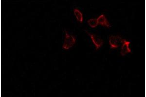ABIN6267277 staining 293 by IF/ICC. (Estrogen Receptor alpha antibody  (pSer106))