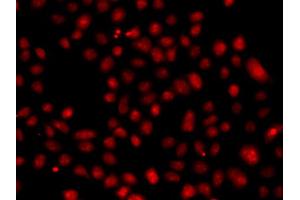 Immunofluorescence analysis of A549 cell using FBXW11 antibody.