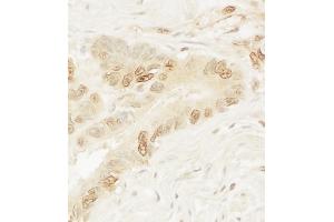 anti-Pygopus Homolog 1 (Drosophila) (PYGO1) (AA 300-350) antibody
