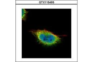 Image no. 3 for anti-Glucocorticoid Modulatory Element Binding Protein 1 (GMEB1) (AA 315-573) antibody (ABIN1501891) (GMEB1 antibody  (AA 315-573))