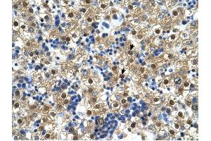 Ctp Synthase antibody was used for immunohistochemistry at a concentration of 4-8 ug/ml to stain Hepatocytes (arrows) in Human Liver.