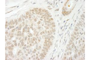 anti-Cleavage Stimulation Factor, 3' Pre-RNA, Subunit 2, 64kDa, tau Variant (CSTF2T) (AA 566-616) antibody