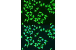 Immunofluorescence analysis of U2OS cells using ATP6 antibody. (MT-ATP6 antibody  (C-Term))