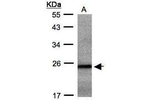 WB Image Sample(30 ug whole cell lysate) A: Hep G2 , 12% SDS PAGE antibody diluted at 1:500