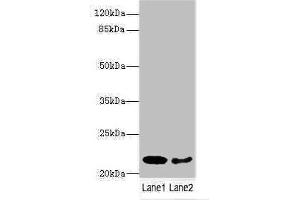 Western blot All lanes: PRDX2 antibody at 9 μg/mL Lane 1: Mouse liver tissue Lane 2: Mouse spleen tissue Secondary Goat polyclonal to rabbit IgG at 1/10000 dilution Predicted band size: 22, 16 kDa Observed band size: 22 kDa (Peroxiredoxin 2 antibody  (AA 2-65))