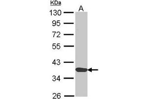 AP31116PU-N ANXA1 antibody staining of H1299 (Lane A) whole cell lysate (30 µg) at 1/1000 dilution. (Annexin a1 antibody  (AA 1-188))