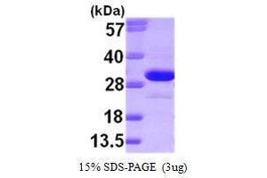 Figure annotation denotes ug of protein loaded and % gel used. (Ketohexokinase Protein (KHK) (AA 1-298))