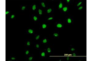 Immunofluorescence of purified MaxPab antibody to CUTL1 on HeLa cell. (CUX1 antibody  (AA 1-676))