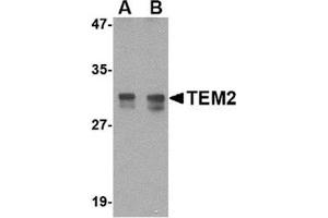Western blot analysis of TEM2 in rat colon tissue lysate with this product at (A) 1 and (B) 2 μg/ml.