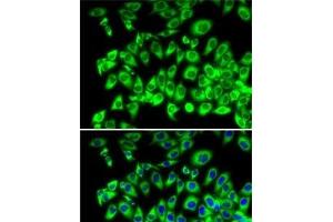Immunofluorescence analysis of MCF7 cells using RPL13 Polyclonal Antibody (RPL13 antibody)