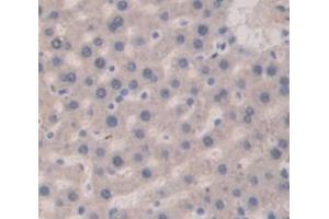 Figure. (Vitamin D-Binding Protein antibody  (AA 395-475))