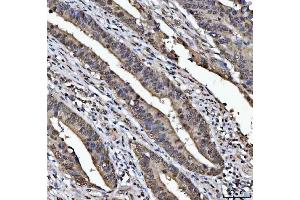 IHC analysis of TIP49A/RUVBL1 using anti-TIP49A/RUVBL1 antibody (ABIN7599928).