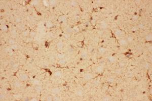Anti-CNTF Picoband antibody,  IHC(P): Rat Brain Tissue (CNTF antibody  (AA 2-198))