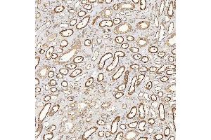 IHC analysis of SFXN3 using anti-SFXN3 antibody (ABIN7601302). (SFXN3 antibody  (AA 32-321))