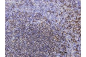 Immunoperoxidase of monoclonal antibody to MS4A1 on formalin-fixed paraffin-embedded human tonsil. (CD20 antibody  (AA 1-297))