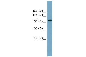 WB Suggested Anti-ELP2 Antibody Titration: 0. (ELP2 antibody  (Middle Region))
