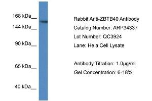 WB Suggested Anti-ZBTB40 Antibody   Titration: 1. (ZBTB40 antibody  (N-Term))