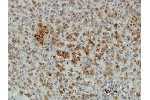Immunoperoxidase of monoclonal antibody to CREG1 on formalin-fixed paraffin-embedded human adrenal gland. (CREG1 antibody  (AA 121-220))