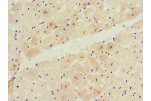 Immunohistochemistry of paraffin-embedded human heart tissue using ABIN7171700 at dilution of 1:100 (TCAP antibody  (AA 1-167))