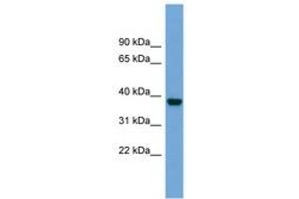 ATP1B4 anticorps  (AA 215-264)