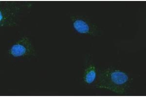 IF analysis of Citrin/SLC25A13 using anti-Citrin/SLC25A13 antibody (ABIN7599512). (slc25a13 antibody  (AA 1-643))
