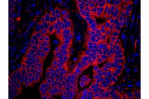 Immunofluorescence (IF) image for anti-RpL7a/SURF3 (C-Term) antibody (ABIN7449015) (RpL7a/SURF3 (C-Term) antibody)