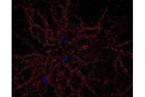 Indirect immunostaining of PFA fixed rat hippocampus neurons (dilution 1 : 500; red).