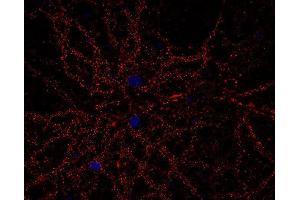 Indirect immunostaining of PFA fixed rat hippocampus neurons (dilution 1 : 500; red).