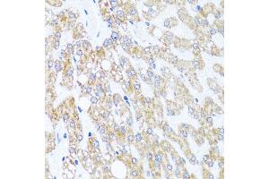 Immunohistochemistry of paraffin-embedded human liver injury using CHD1 antibody (ABIN5975217) at dilution of 1/100 (40x lens). (CHD1 antibody)