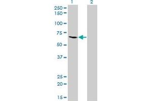 Western Blotting (WB) image for anti-Malic Enzyme 1, NADP(+)-Dependent, Cytosolic (ME1) (AA 1-573) antibody (ABIN598801) (ME1 antibody  (AA 1-573))