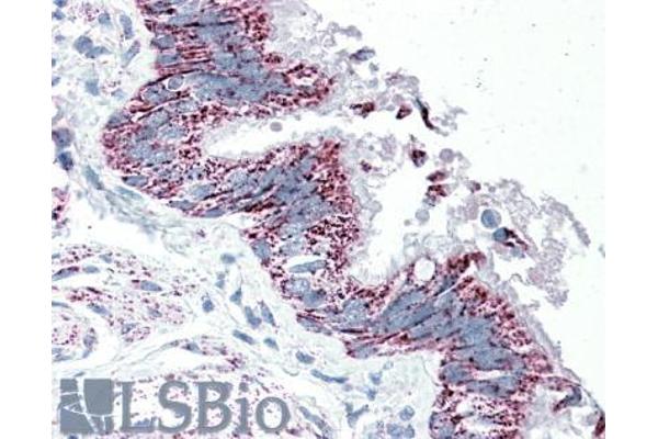 TTLL4 anticorps  (Internal Region)